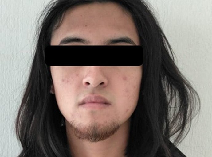 Prestador de Servicio Social Acusado de Violación detenido en Coacalco