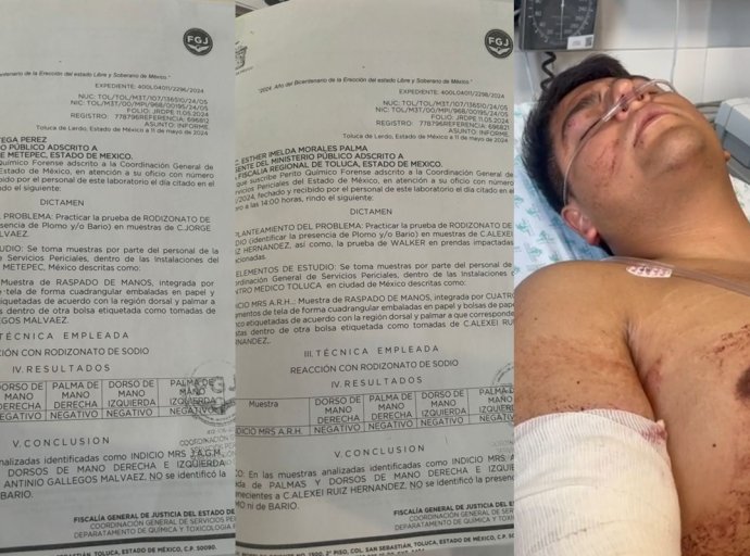 Peritajes Confirman Ataque Directo a Hijo de Candidato de Morena en Metepec