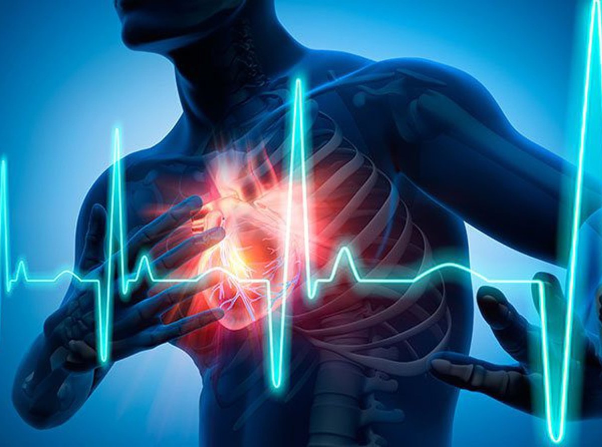 De refrescos a infartos: Cómo los hábitos mexicanos alimentan la principal causa de muerte