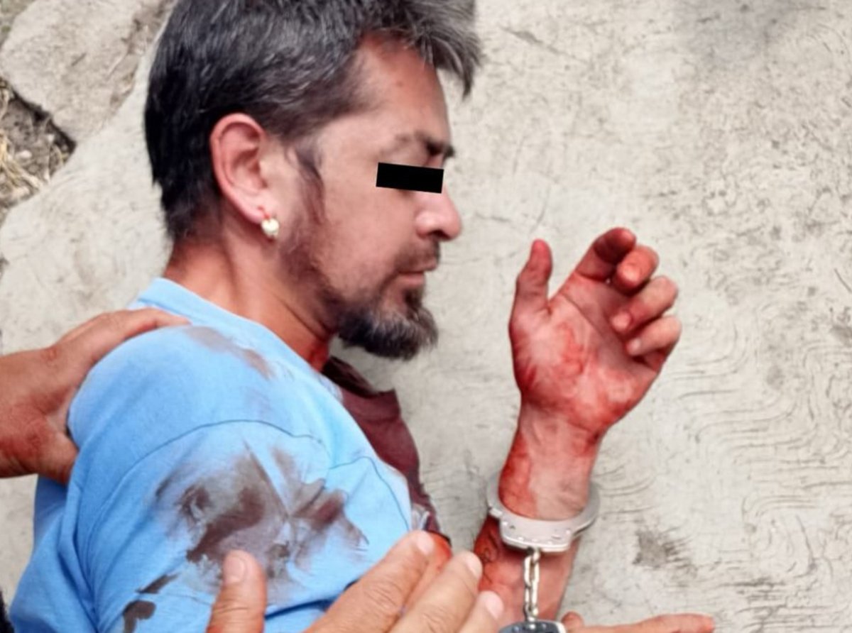 Ecatepec: Sujeto Agrede con Cuchillo a Cuatro Familiares